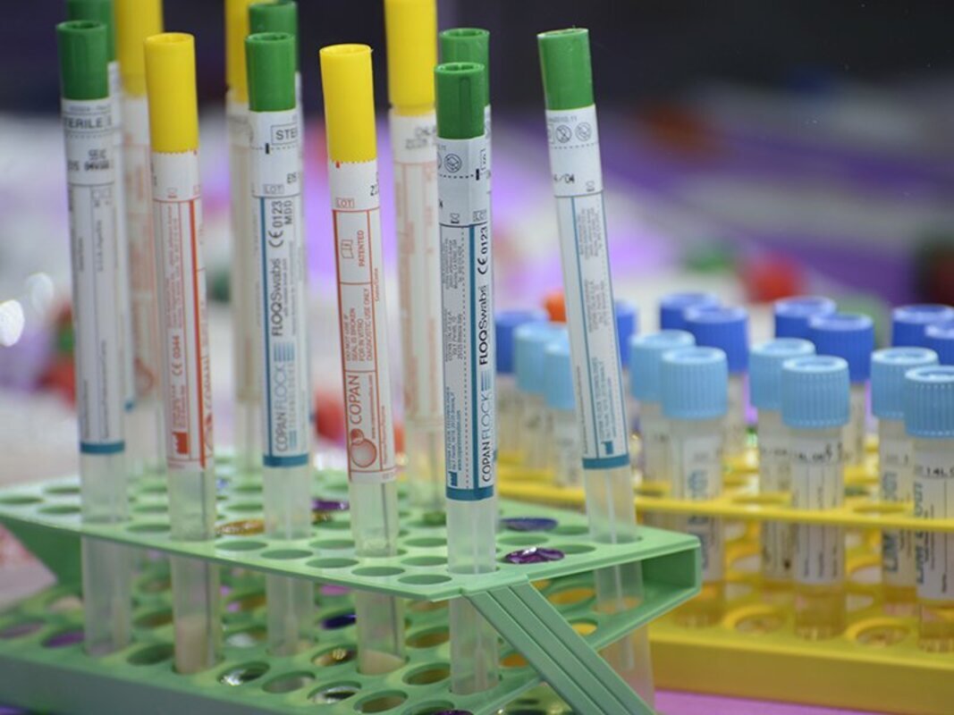 Shinako Inaida and Shigeo Matsuno. Инфекции в анамнезе позитивно коррелируют с частотой опухолей у пациентов с онкологическими заболеваниями