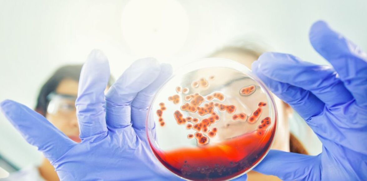 Sidhartha R. Sinha et al.  Дисбиоз-индуцированный вторичный дефицит желчной кислоты способствует развитию воспаления кишечника.