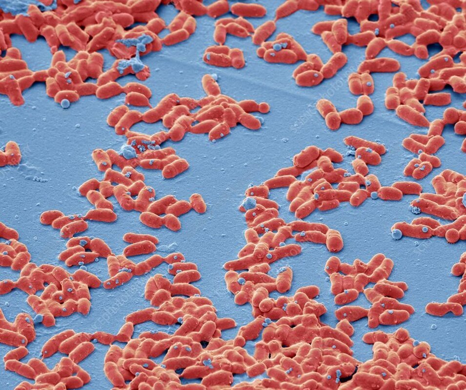 Jason Zou et al.  Фенотипические и генотипические корреляты чувствительности пенициллина к нетоксигенным коринебактериям, Британская Колумбия, Канада, 2015-2018 гг.