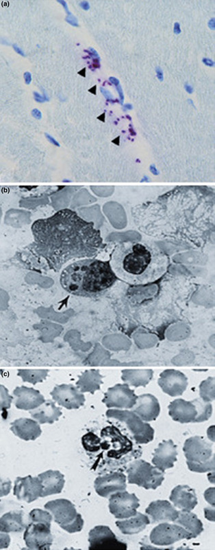 Hao Li et al.  Инфекции, вызванные Rickettsia japonica у людей, Синьян, Китай, 2014-2017 гг.