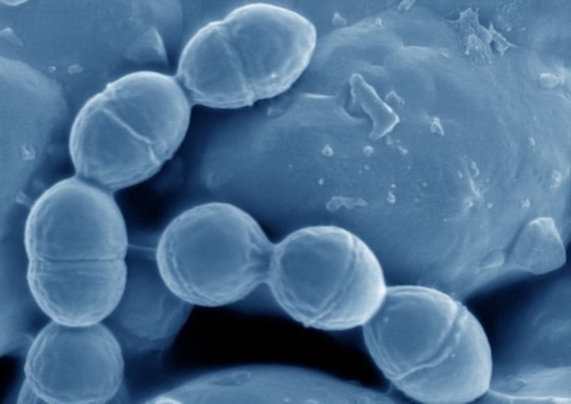 Широкомасштабный анализ генома связывает молочнокислые бактерии из пищи с микробиомом кишечника