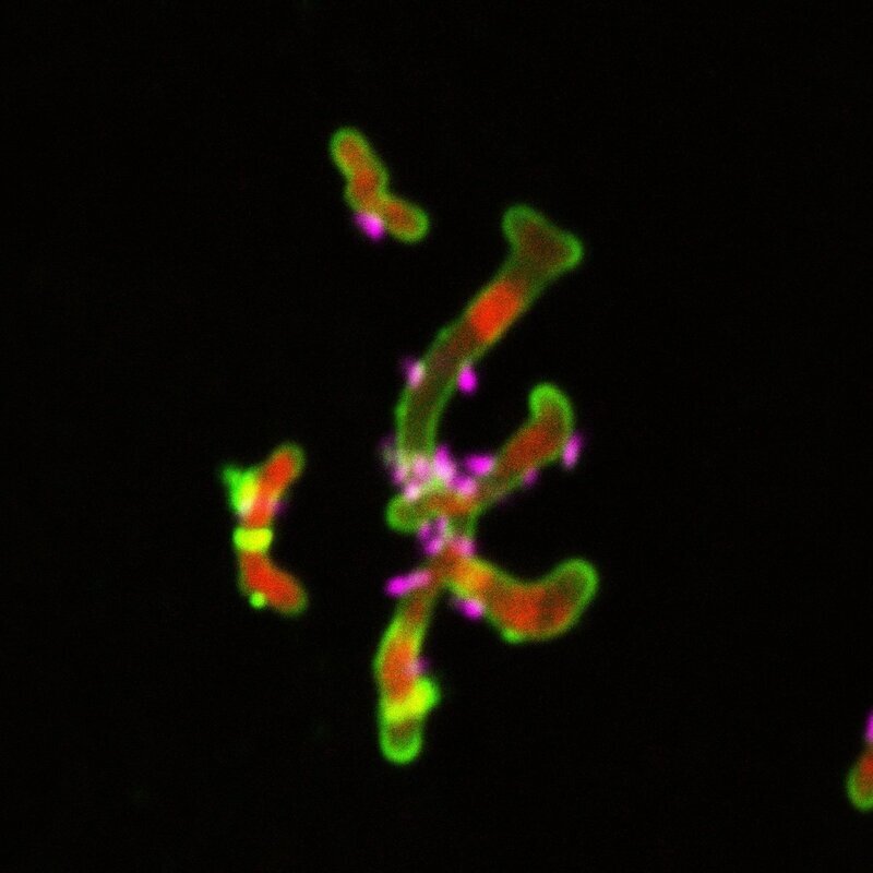 Ультра-маленькие паразитарные бактерии найдены в грунтовых водах, лосях и в... вас
