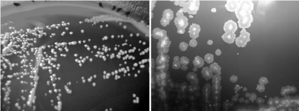 Рекомендации избегания водопроводной воды уменьшает уровень больничной заболеваемости, вызванной легочными нетуберкулезными микобактериями