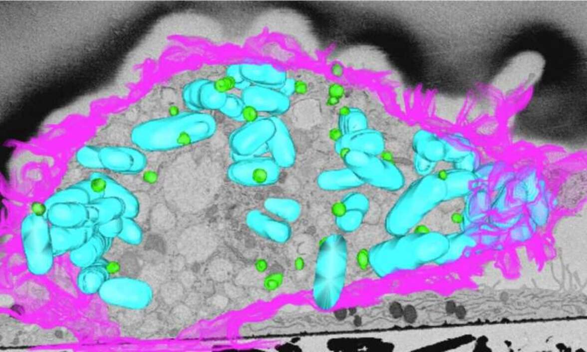 Жиры, борющиеся с бактериями