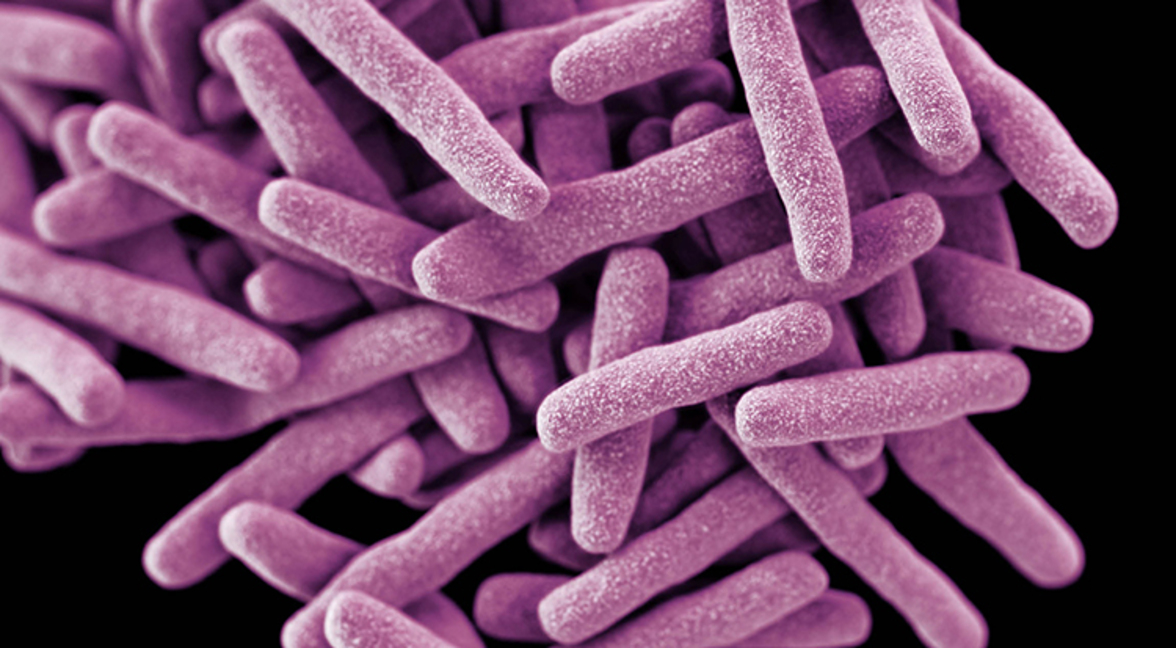 Как возбудитель туберкулеза быстро развивает  устойчивость к антибиотикам