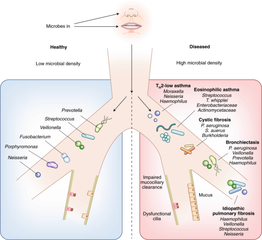 ХОБЛ и микробиом (аннотация)