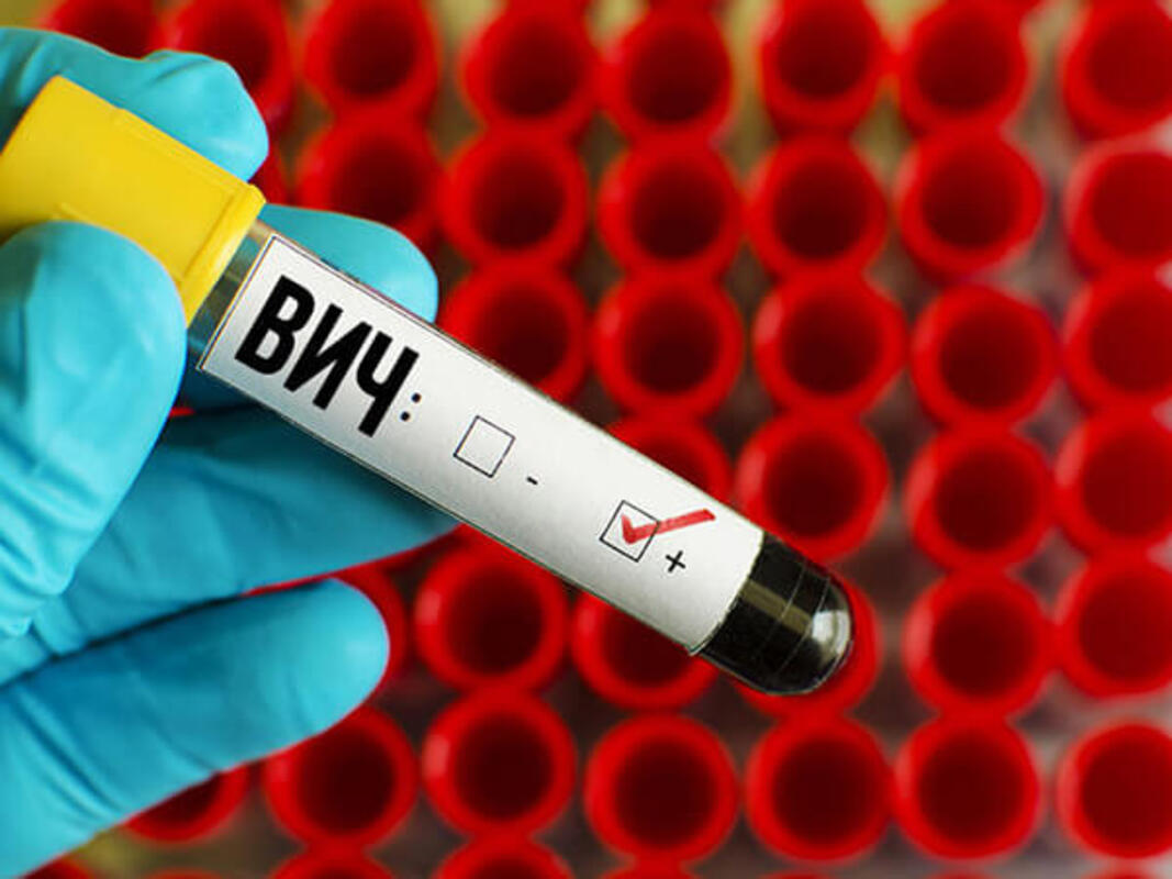 Наиболее сложная ситуация с ВИЧ-инфекцией наблюдается в 5 регионах РФ