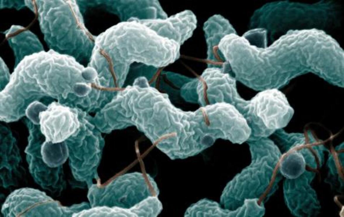 Эффектор CiaD, секретируемый Campylobacter jejuni облегчает проникновение в клетки хозяина (аннотация)