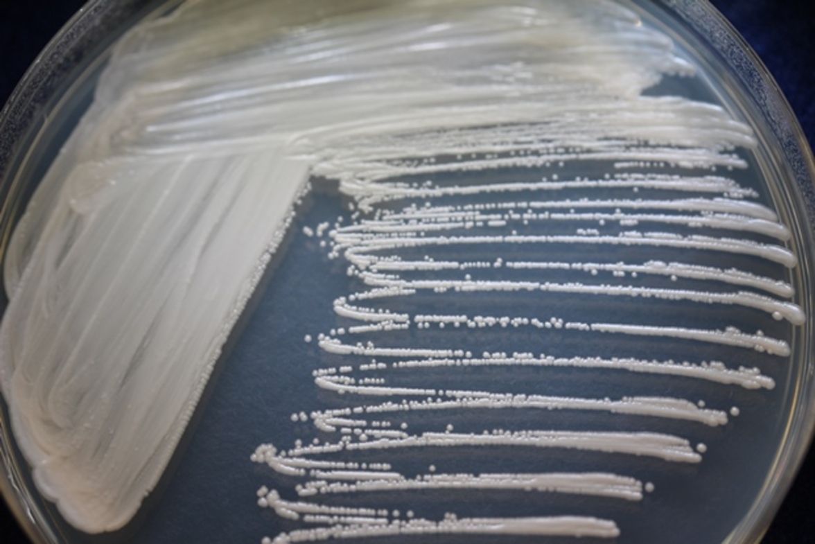 Debaryomyces в интестинальных тканях при болезни Крона препятствуют заживлению слизистой