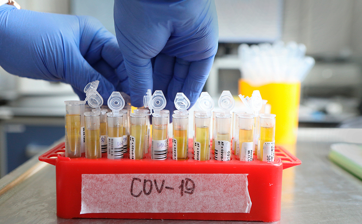 На производство тест-систем на КОВИД-19 Роспотребнадзор получил 2,9 млрд. рублей