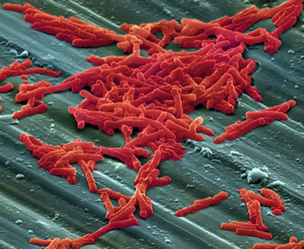 Безлотоксумаб снижает вероятность рецидива инфекции C. difficile у реципиентов трансплантатов