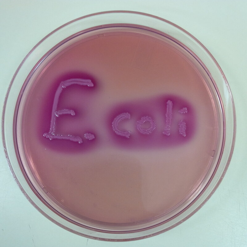 Является ли кислотность бактерий ключом к решению проблемы резистентности к противомикробным препаратам?