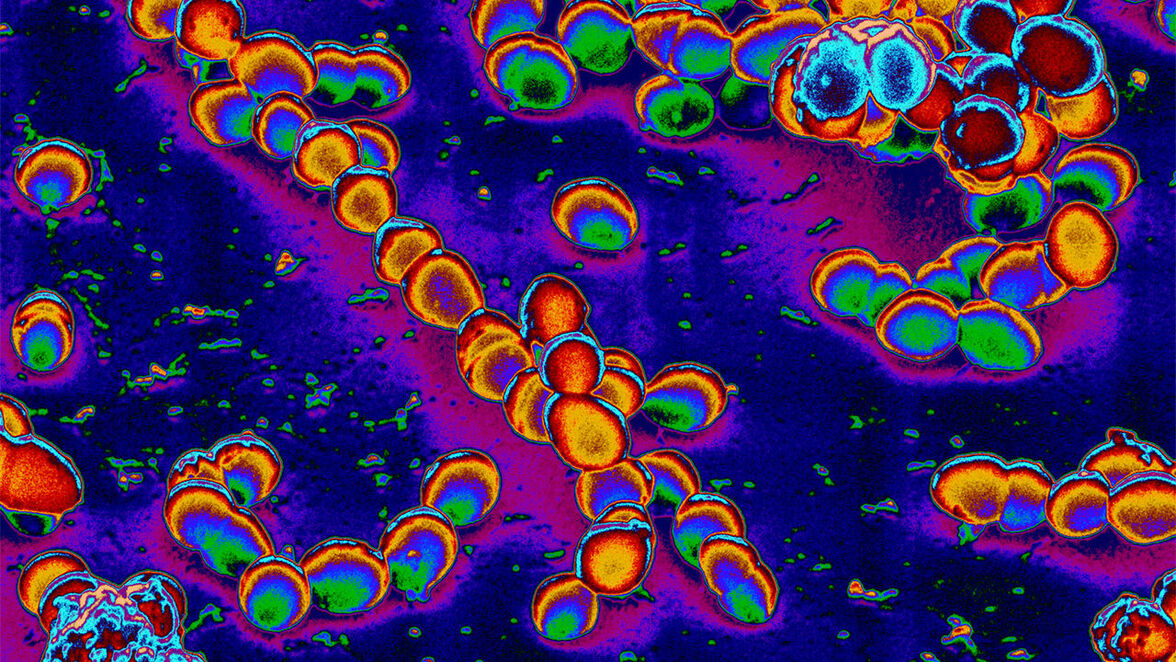 Новый кал, новый ты? Фекальная трансплантация обращает вспять признаки старения мозга у мышей