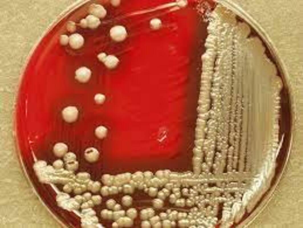 Bacillus cereus в упаковочных материалах: выявленное молекулярное и фенотипическое разнообразие (аннотация)