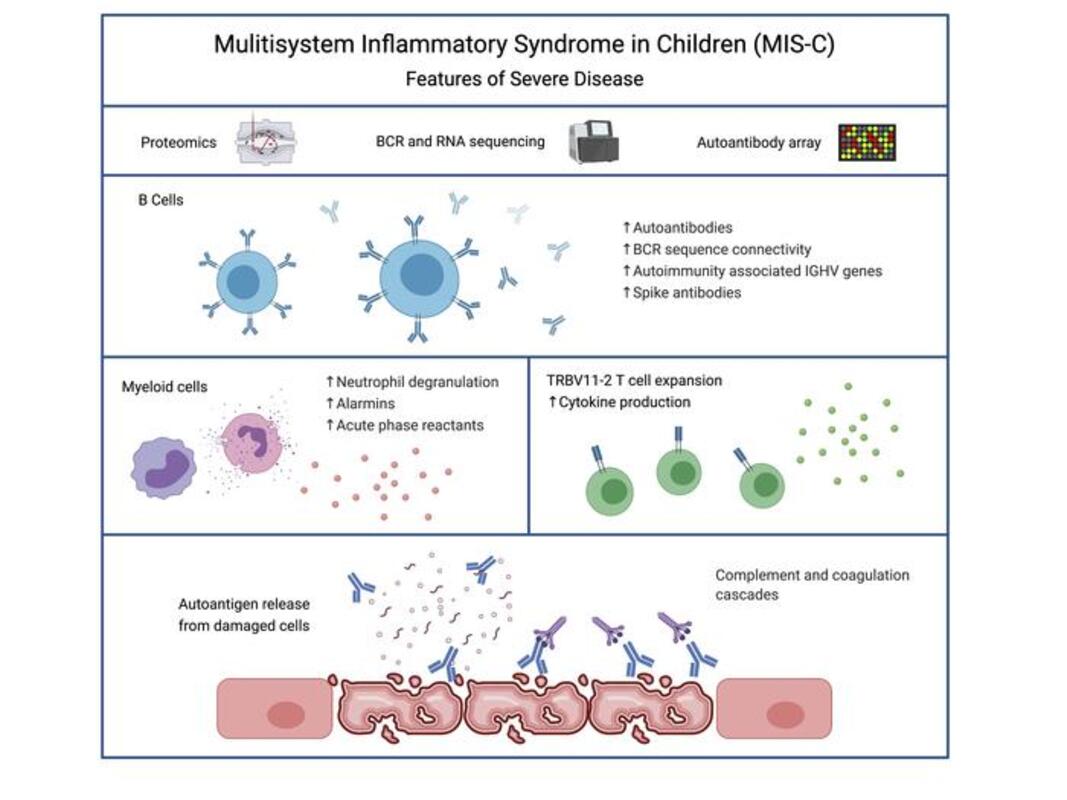 Найдены биомаркеры мультисистемного воспалительного синдрома при COVID-19 у детей