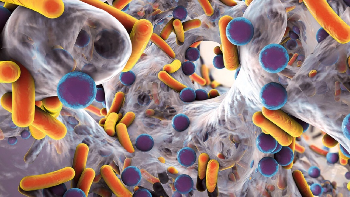 Динамические изменения в транскрипционных сигнатурах единичных клеток человека во время фатального сепсиса