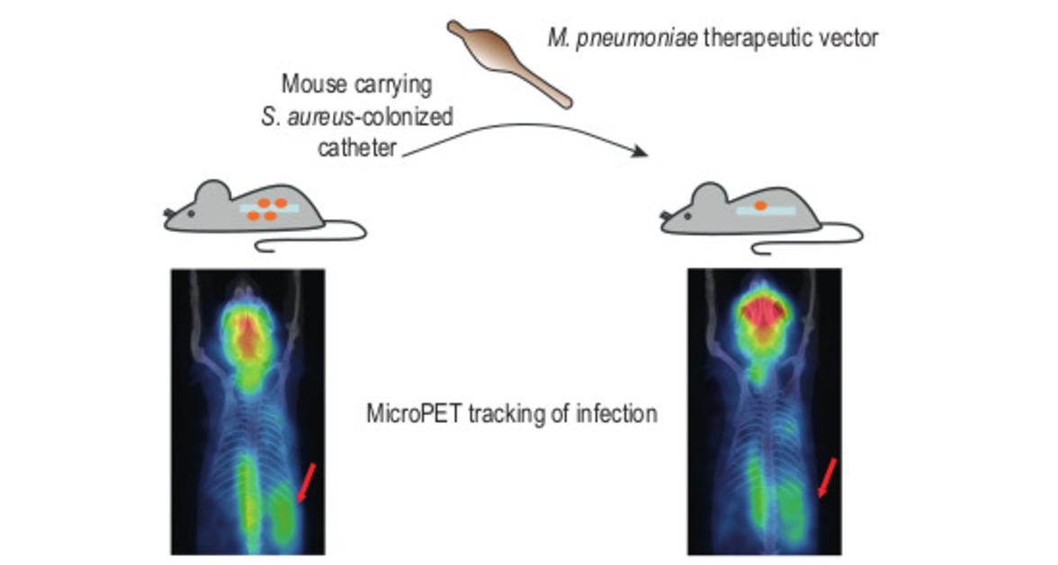 Создано "живое лекарство" для лечения резистентных к лекарствам инфекций