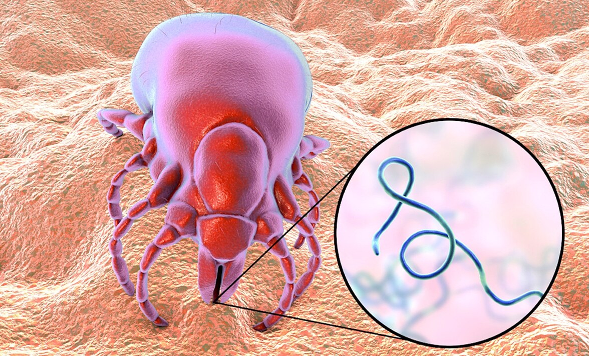 Возможное альтернативное лечение болезни Лайма