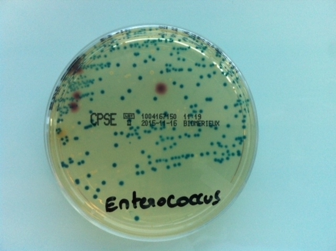 Воздействие одного антибиотика приводит к приобретению резистентности к другому антибиотику через Quorum Sensing механизмы