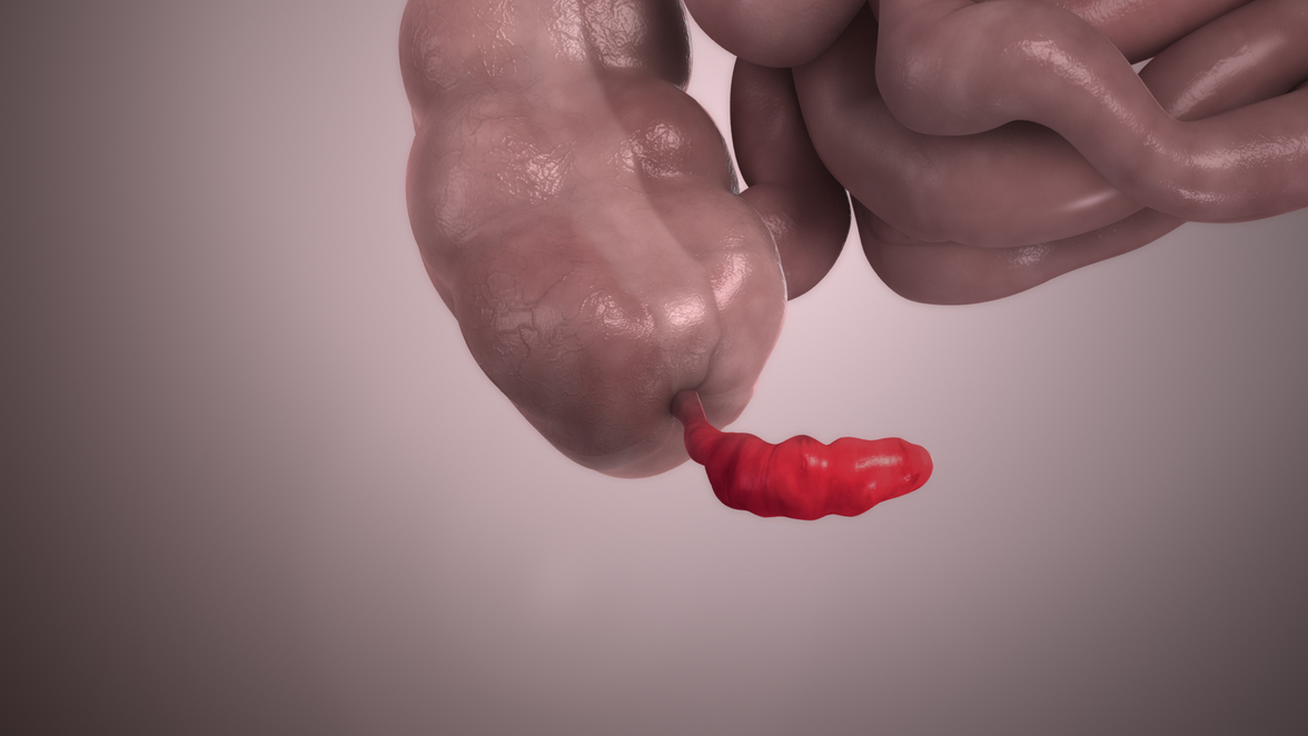 Антибиотики при лечении аппендицита