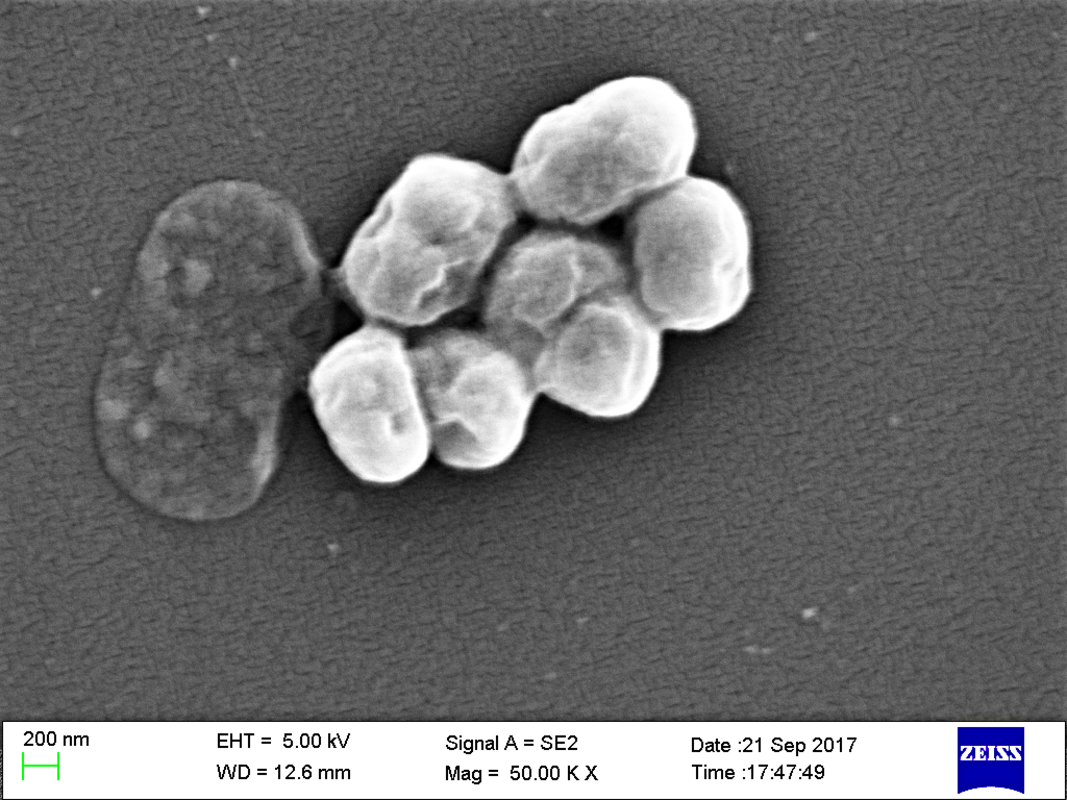Ингибирование или подавление Quorum Sensing у Acinetobacter baumannii: новые терапевтические стратегии для разработки новых лекарственных препаратов