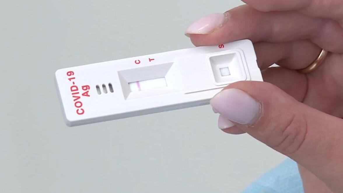 Правительство РФ выделяет финансирование на закупку 14 млн. экспресс-тестов на COVID-19