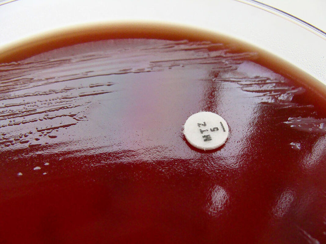 Исследование на мышах показывает, как диета изменяет функцию иммунной системы при посредничестве кишечного микробиома