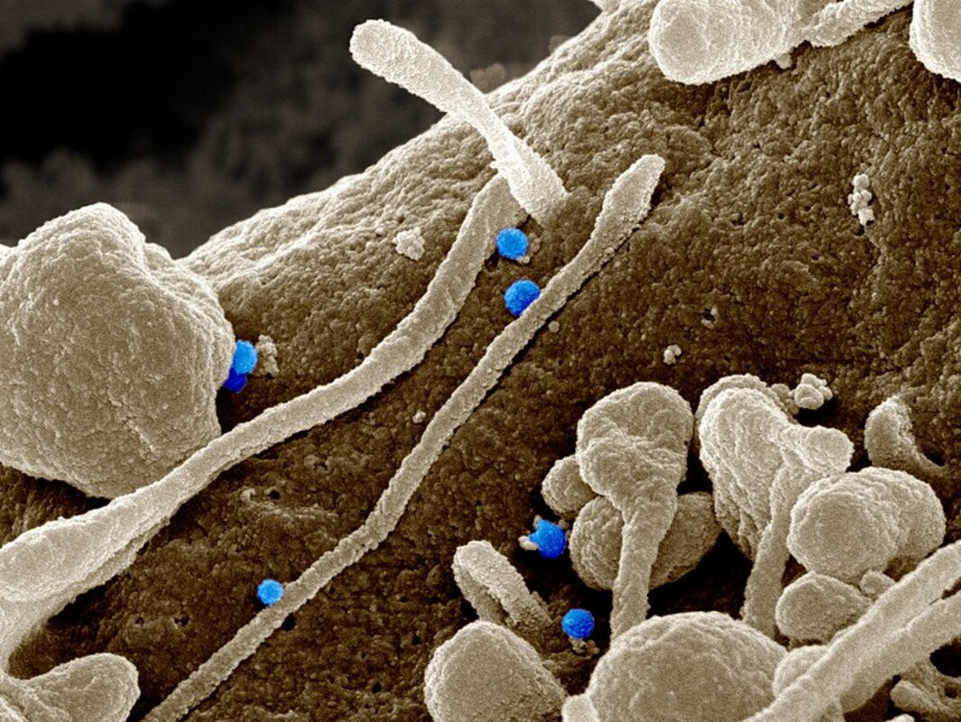 Прорыв в борьбе с возбудителем крымской геморрагической лихорадки