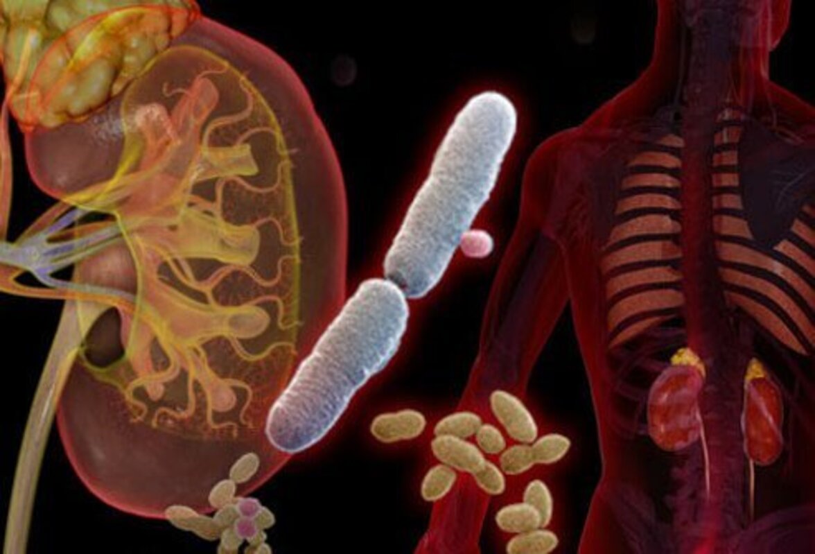 Раскрывая причины делирия, вызванного ИМП