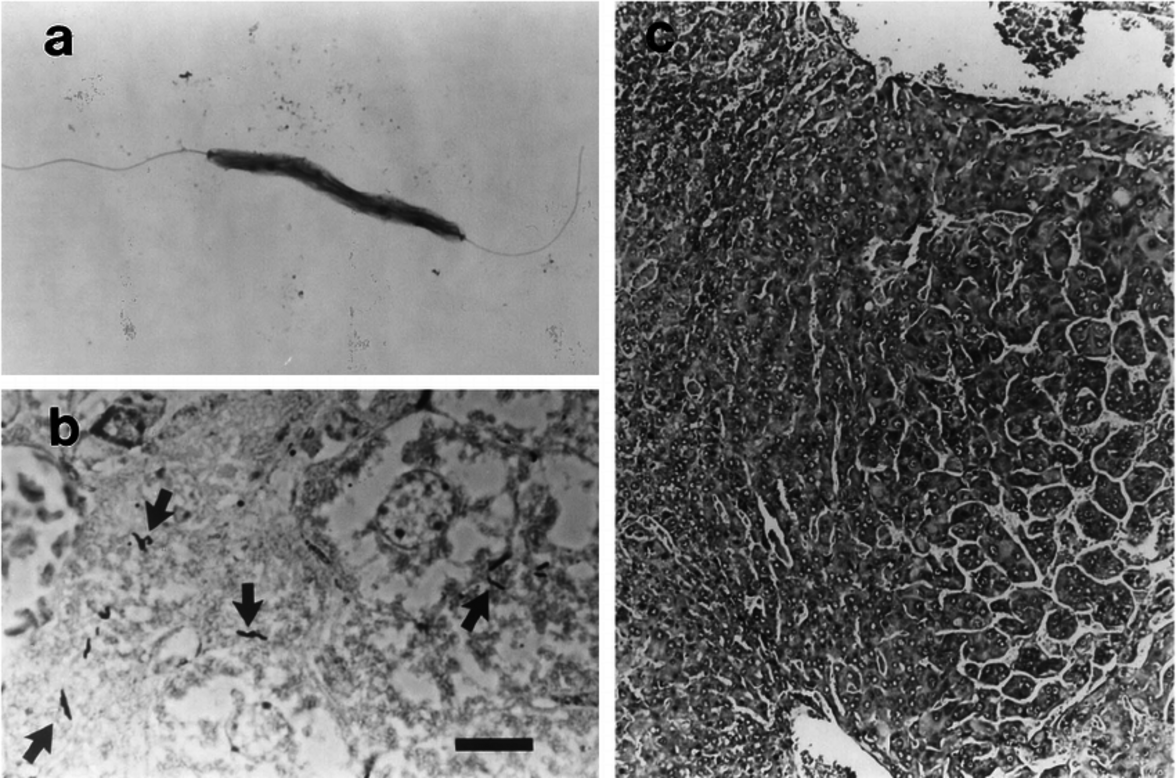 Добавление одного вида бактерий в микробиом кишечника повысило противоопухолевый иммунитет у мышей