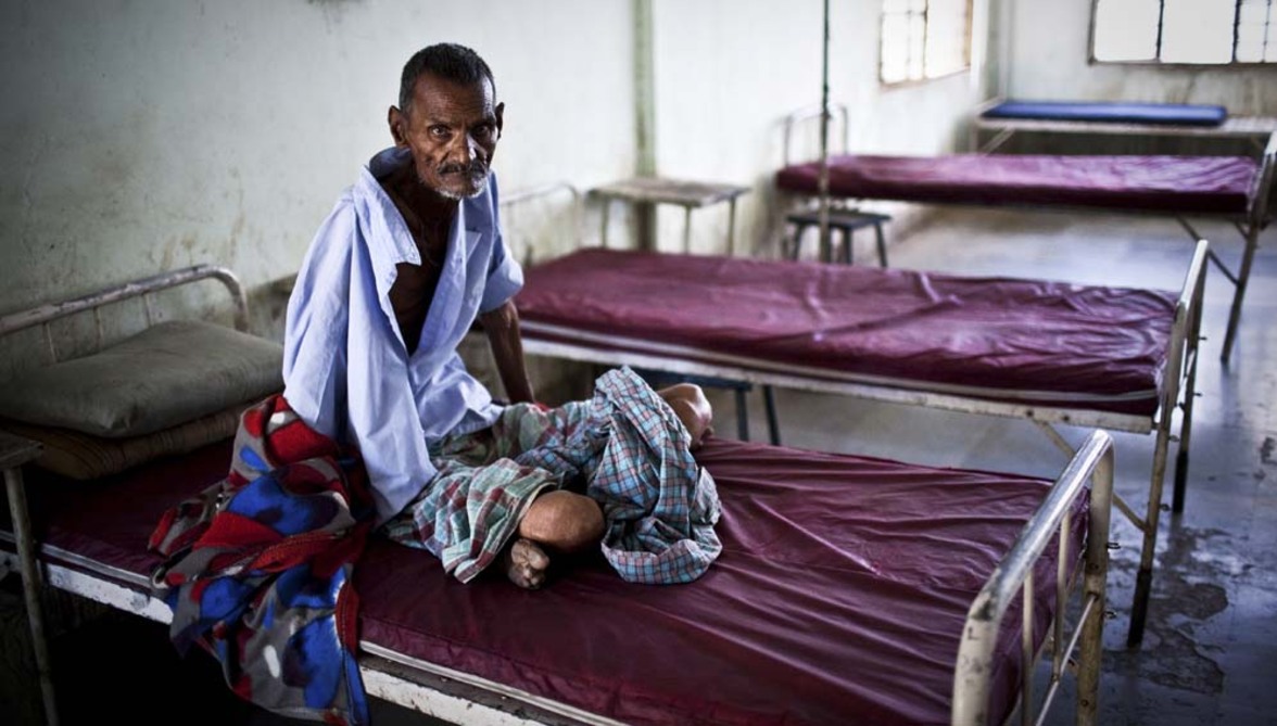 Финансирование исследований в области туберкулеза значительно отстает от целевого показателя ООН