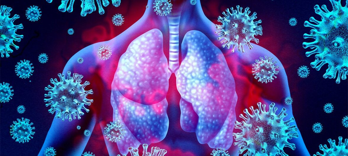 Начальная тяжесть COVID-19 коррелирует с неблагоприятным легочным исходом через 1 год