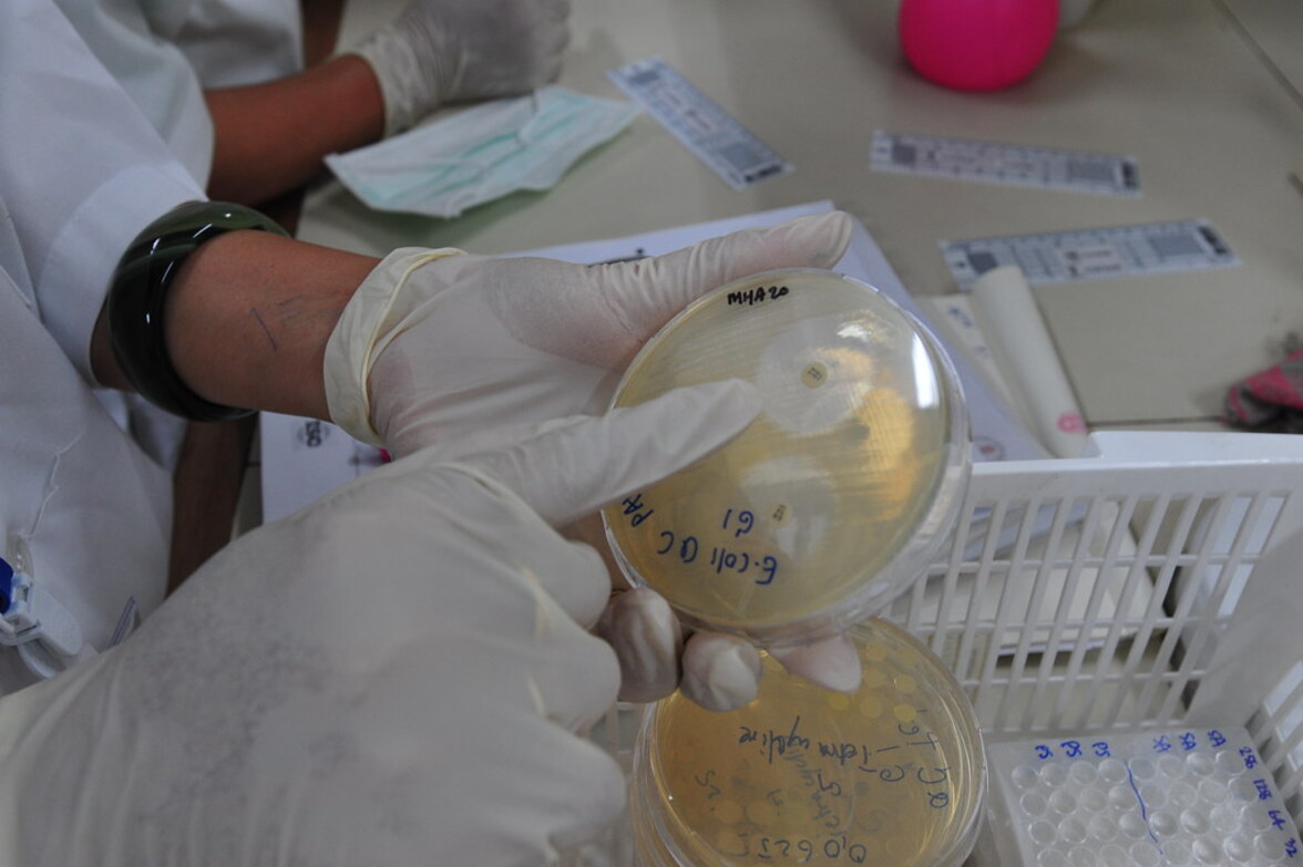 Миллионы людей умирают от инфекций, резистентных к лекарственным препаратам, говорится в глобальном отчете