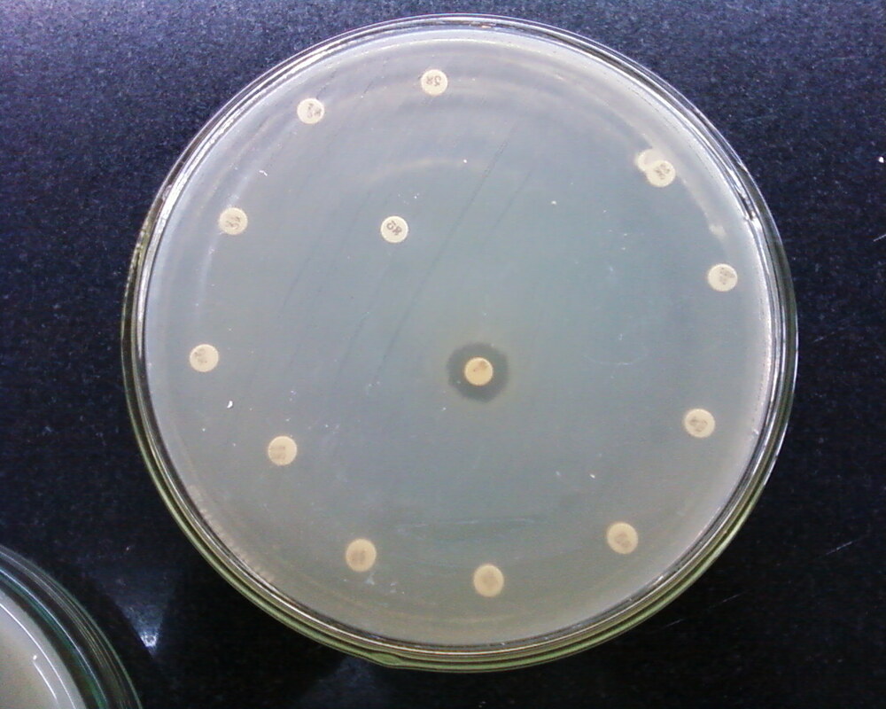 Новый метод оценивает эволюционные риски антибиотиков