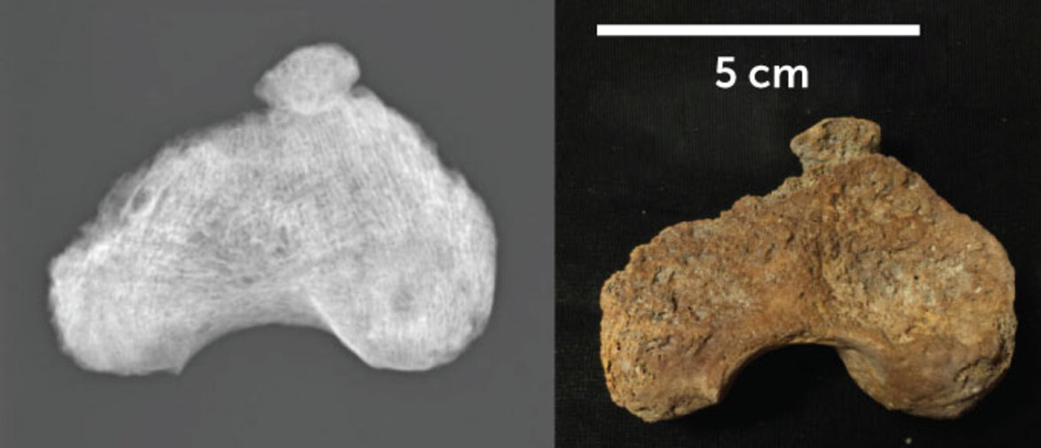 Смертельная бактерия инфицирует детей уже более 1 400 лет