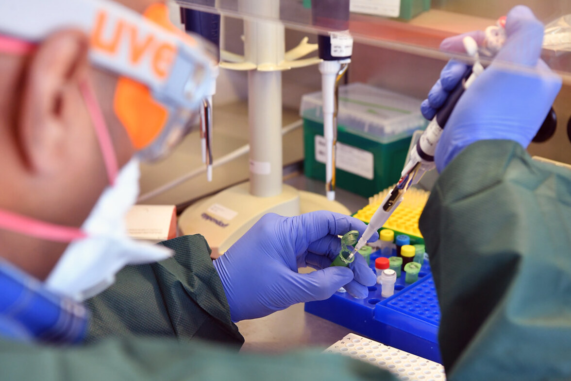 ФАС будет регулировать цены на ПЦР-тестирование COVID-19