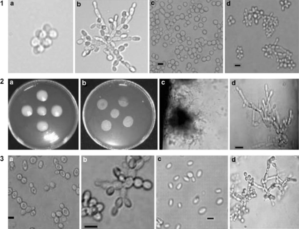 Исследование может помочь защитить людей и сельскохозяйственные культуры от дрожжевых инфекций