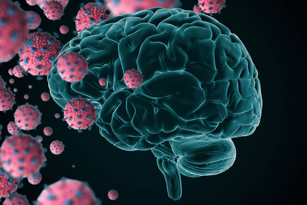 Изменения в головном мозге после COVID-19
