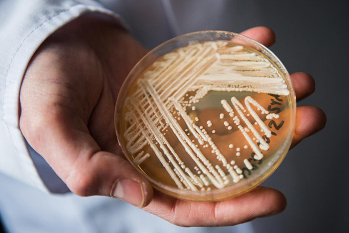 Поверхности вблизи пациентов с C. auris обычно повторно контаминировались в течение нескольких часов после уборки