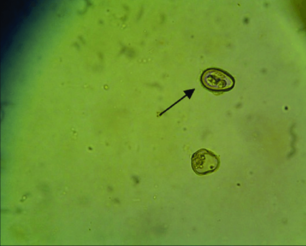Друг, а не враг: как паразиты способствуют здоровью кишечника