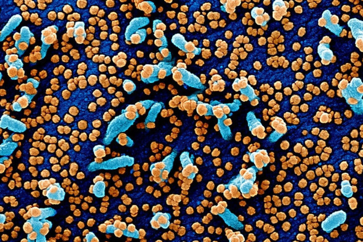 Изменение чувствительности бактериальной флоры у больных COVID-19