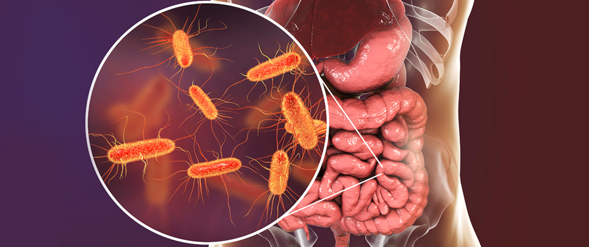 Е. coli использует воспаление при болезни Крона