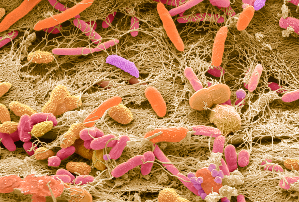 Игра на троих: модели взаимодействия сальмонелла-хозяин-микробиота