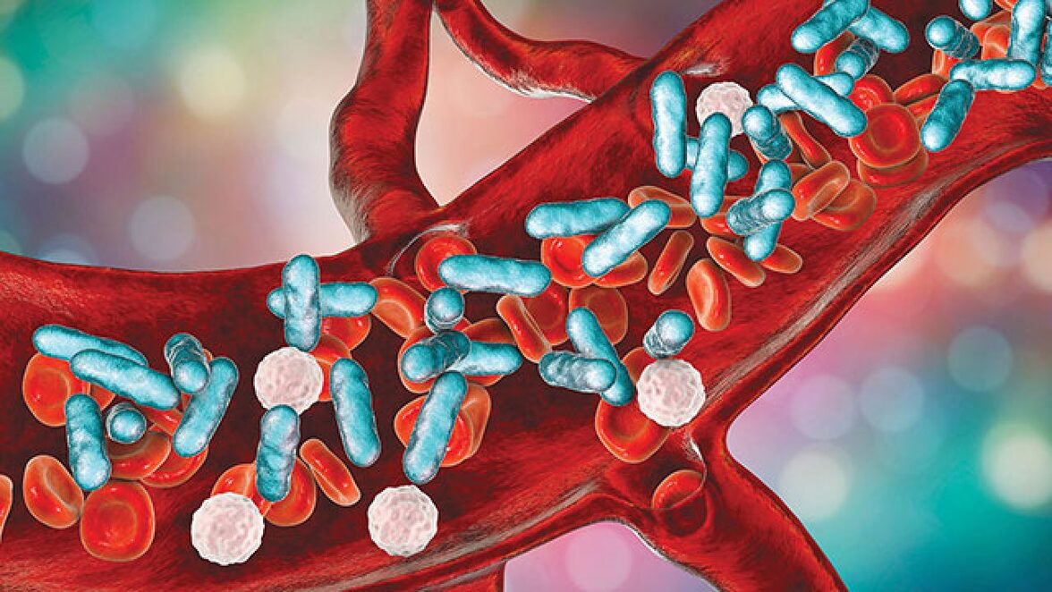 Активное наблюдение за культурами и прокальцитонином в сочетании с клиническими данными для руководства эмпирической антимикробной терапией у госпитализированных пациентов с сепсисом