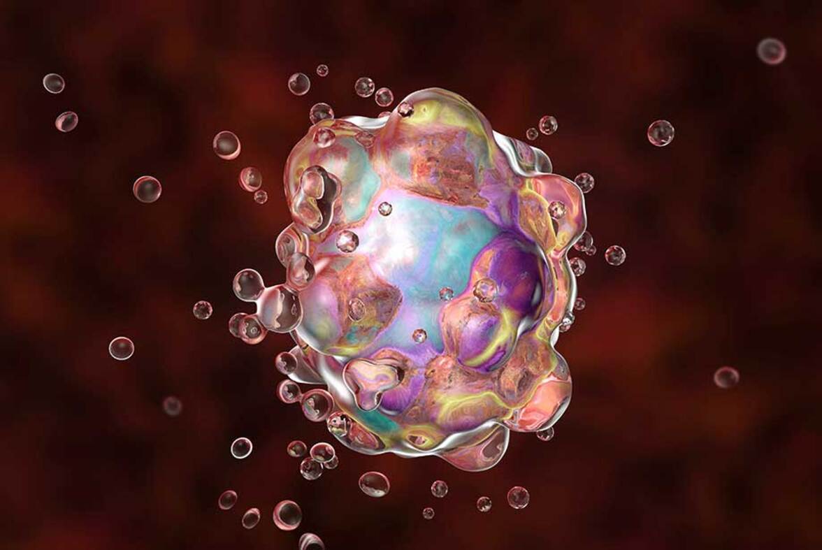 Эребоз - новая форма клеточной смерти