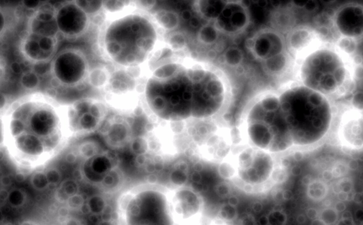 Геномы SARS-CoV-2 персистируют в желудочно-кишечном тракте после прекращения инфекции