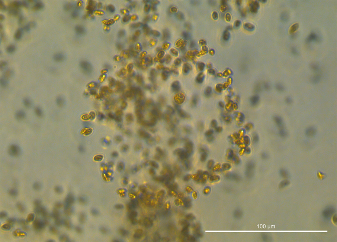 Морской микроорганизм заманивает добычу в специальные ловушки из слизи