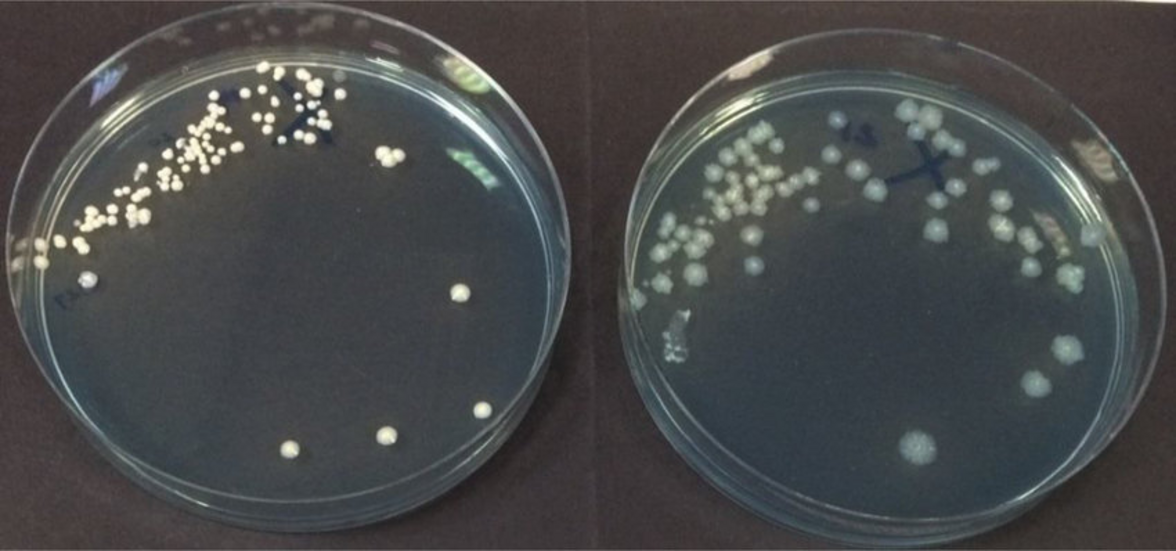 Mycobacterium abscessus; парадокс низкой патогенности и высокой вирулентности