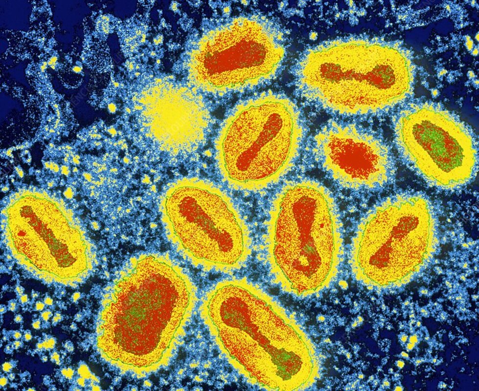 Белки поксвируса позволяют нанести ранний удар по иммунной защите