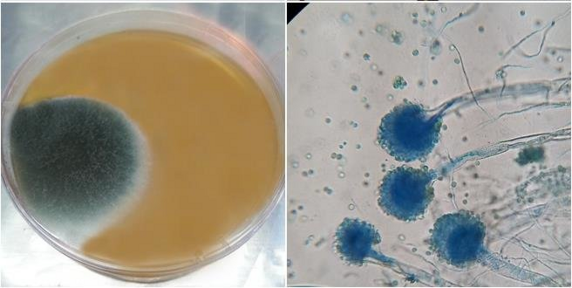 Новые варианты лечения азолорезистентного A. fumigatus